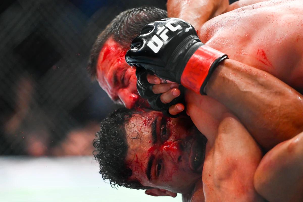 Luke Rockhold uses his gushing broken nose to smear blood all over Costa's face.